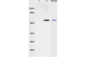 L1 rat intestine lysates L2 rat brain lysates probed with Anti SOAT2/ACAT2 Polyclonal Antibody, Unconjugated (ABIN708476) at 1:200 overnight at 4 °C.