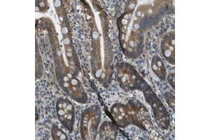 Immunohistochemical staining of human duodenum with TMEM51 polyclonal antibody  shows moderate cytoplasmic positivity in glandular cells at 1:50-1:200 dilution. (TMEM51 anticorps)