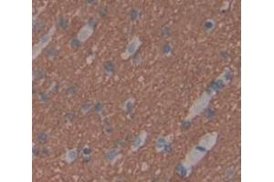 IHC-P analysis of Human Tissue, with DAB staining. (TWSG1 anticorps  (AA 26-223))