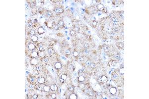 Immunohistochemistry of paraffin-embedded human liver using AADAT Rabbit pAb (ABIN6127318, ABIN6136315, ABIN6136317 and ABIN6216952) at dilution of 1:200 (40x lens). (AADAT anticorps  (AA 34-429))