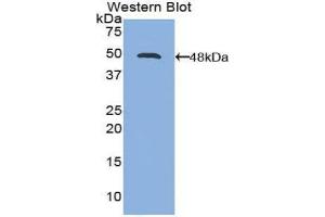 Western Blotting (WB) image for anti-Interleukin 21 (IL21) (AA 23-155) antibody (ABIN1174928) (IL-21 anticorps  (AA 23-155))