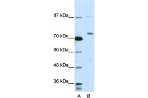 Western Blotting (WB) image for anti-Exosome Component 10 (EXOSC10) antibody (ABIN2462060) (EXOSC10 anticorps)
