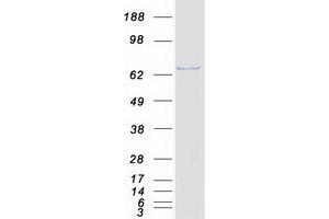Validation with Western Blot