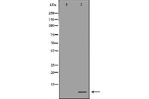 Western blot analysis of Hela cell lysate, using MT2A Antibody.