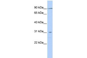 WB Suggested Anti-TMEM146 Antibody Titration: 0. (TMEM146 anticorps  (N-Term))