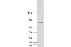 Validation with Western Blot