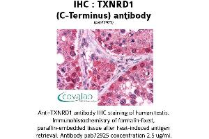Image no. 2 for anti-Thioredoxin Reductase 1 (TXNRD1) (C-Term) antibody (ABIN1740489) (TXNRD1 anticorps  (C-Term))