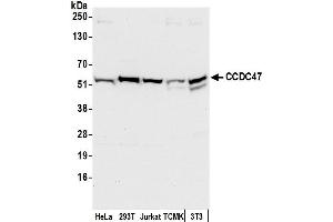 Western Blotting (WB) image for anti-Coiled-Coil Domain Containing 47 (CCDC47) (AA 433-483) antibody (ABIN7450079)