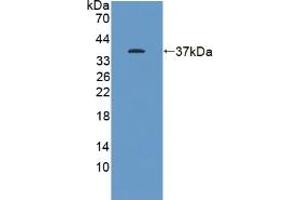 Western blot analysis of recombinant Human KEAP1. (KEAP1 anticorps  (AA 327-624))
