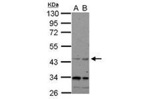 Image no. 1 for anti-CHRNA7 (Cholinergic Receptor, Nicotinic, alpha 7, Exons 5-10) and FAM7A (Family with Sequence Similarity 7A, Exons A-E) Fusion (CHRFAM7A) (AA 1-177) antibody (ABIN1497505) (CHRFAM7A anticorps  (AA 1-177))