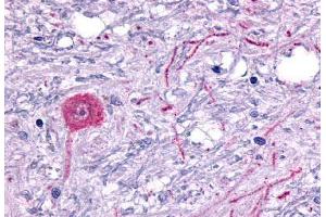 Anti-HTR6 / 5-HT6 antibody  ABIN1048968 IHC staining of human brain, neuron.