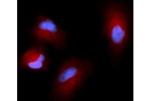 Immunofluorescence (IF) image for anti-Cystatin SN (CST1) (AA 21-141) antibody (APC) (ABIN5568436)