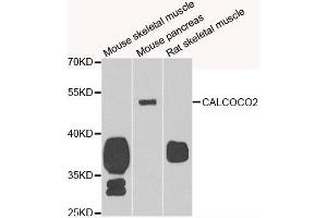 Western blot analysis of extracts of various cell lines, using CALCOCO2 antibody. (CALCOCO2 anticorps)