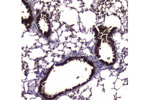 IHC analysis of CES1 using anti-CES1 antibody .