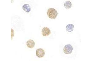 anti-FYN-Binding Protein (FYB) (C-Term) antibody