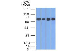 Western Blot of HT20, A549, 293 and A431 cell lysates using C Catenin, gamma Mouse Monoclonal Antibody (11E4).
