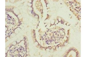 Immunohistochemistry of paraffin-embedded human small intestine tissue using ABIN7172381 at dilution of 1:100 (DHDH anticorps  (AA 1-334))