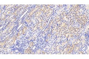 Detection of GSS in Human Kidney Tissue using Polyclonal Antibody to Glutathione Synthetase (GSS) (Glutathione Synthetase anticorps  (AA 268-474))