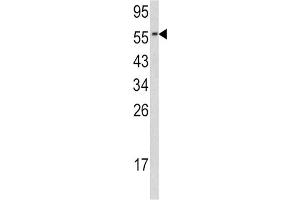 Western Blotting (WB) image for anti-Cell Division Cycle 23 (CDC23) antibody (ABIN3002712) (CDC23 anticorps)