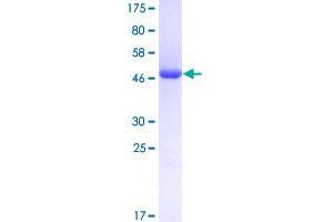 Image no. 1 for MAX Interactor 1 (MXI1) (AA 1-182) protein (GST tag) (ABIN1311691)