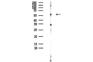 Western blot analysis of lysates from HepG2 cells(heat-shock,45 min treatment), using FGR Antibody at 1/1000 dilution.