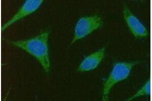 ICC/IF analysis of TBCEL in PC3 cells line, stained with DAPI (Blue) for nucleus staining and monoclonal anti-human TBCEL antibody (1:100) with goat anti-mouse IgG-Alexa fluor 488 conjugate (Green).