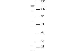 SIP1 antibody (pAb) tested by Western blot Nuclear extract of Saos-2 cells (20 μg per lane) probed with SIP1 antibody (pAb) at a dilution of 1:500. (SIP1 anticorps  (N-Term))