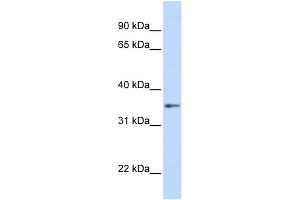 WB Suggested Anti-GNB1 Antibody Titration: 0. (GNB1 anticorps  (C-Term))