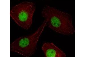 Fluorescent image of U251 cell stained with PR antibody at 1:25.