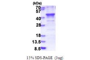 SDS-PAGE (SDS) image for BRISC and BRCA1 A Complex Member 1 (BABAM1) (AA 1-329) protein (His tag) (ABIN5853835)