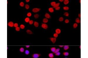Immunofluorescence analysis of HeLa cells using CYBA Polyclonal Antibody at dilution of 1:100 (40x lens). (CYBA anticorps)