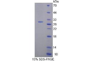 SDS-PAGE (SDS) image for BCL2-Associated Athanogene 5 (BAG5) (AA 1-217) protein (His tag) (ABIN6239582)
