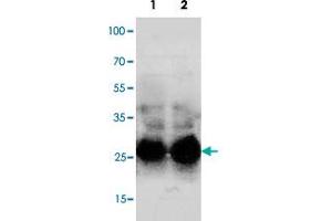 Western blot analysis of mouse lung with Sftpa1 polyclonal antibody . (Surfactant Protein A1 anticorps  (C-Term))