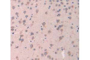 IHC-P analysis of Mouse Tissue, with DAB staining. (ESM1 anticorps  (AA 22-184))