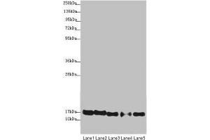 Western blot All lanes: ATP5F1D antibody at 1.