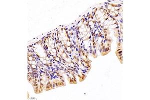 Immunohistochemistry of paraffin embedded mouse colon using TFIIIC110 (ABIN7074038) at dilution of 1:2500 (400x lens)