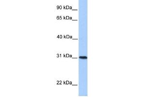 WB Suggested Anti-HELT Antibody Titration:  0.