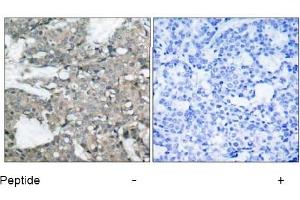Image no. 1 for anti-Mitogen-Activated Protein Kinase Kinase 1 (MAP2K1) (Ser221) antibody (ABIN197388) (MEK1 anticorps  (Ser221))