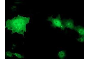 Anti-TOMM34 mouse monoclonal antibody (ABIN2454814) immunofluorescent staining of COS7 cells transiently transfected by pCMV6-ENTRY TOMM34 (RC201083). (TOMM34 anticorps)