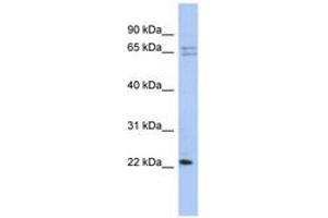 Image no. 1 for anti-Ribosomal Protein L18 (RPL18) (N-Term) antibody (ABIN6743981) (RPL18 anticorps  (N-Term))