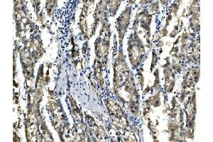 IHC analysis of Sorbitol Dehydrogenase/ SORD using anti-Sorbitol Dehydrogenase/ SORD antibody (ABIN7602486).