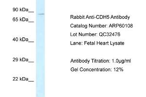 Western Blotting (WB) image for anti-Cadherin 5 (CDH5) (Middle Region) antibody (ABIN2788335) (Cadherin 5 anticorps  (Middle Region))