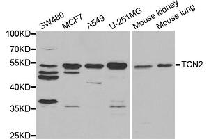 Western blot analysis of extracts of various cell lines, using TCN2 antibody. (TCN2 anticorps)