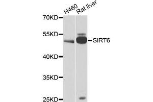 Western blot analysis of extracts of various cell lines, using CALU antibody (ABIN6291516) at 1:1000 dilution. (CALU anticorps)