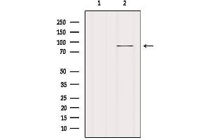 Western blot analysis of extracts from Mouse spleen, using FAKD5 Antibody.
