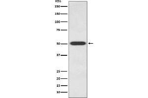 Western blot analysis of Endothelin B Receptor expression in 293T cell lysate.
