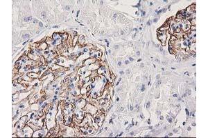 Immunohistochemical staining of paraffin-embedded Human Kidney tissue using anti-PDLIM2 mouse monoclonal antibody. (PDLIM2 anticorps)