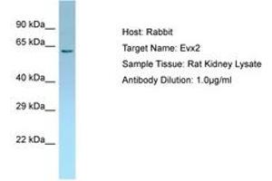 Image no. 1 for anti-Homeobox even-skipped homolog protein 2 (EVX2) (AA 51-100) antibody (ABIN6749824) (EVX2 anticorps  (AA 51-100))