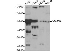 Western blot analysis of extracts of various cell lines, using STAT5B antibody. (STAT5B anticorps)