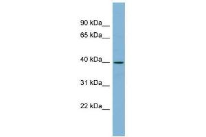 Western Blot showing ETV3L antibody used at a concentration of 1-2 ug/ml to detect its target protein. (ETV3L anticorps  (Middle Region))